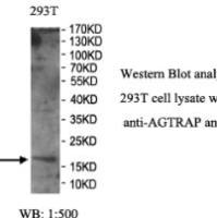 AGTRAP Antibody