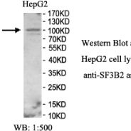 SF3B2 Antibody