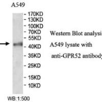 GPR52 Antibody