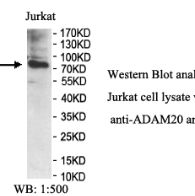 ADAM20 Antibody