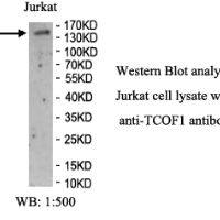 TCOF1 Antibody