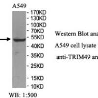 TRIM49 Antibody