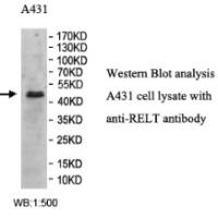 RELT Antibody