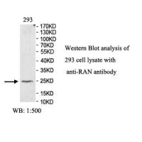 RAN Antibody
