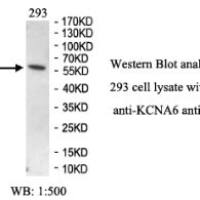 KCNA6 Antibody