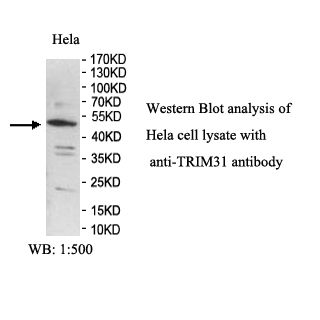 TRIM31 Antibody