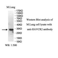 HAVCR2 Antibody