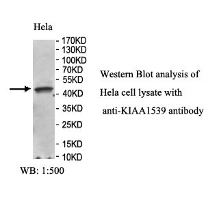 KIAA1539 Antibody