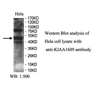 KIAA1609 Antibody
