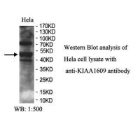 KIAA1609 Antibody