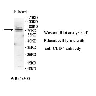 CLIP4 Antibody
