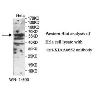 KIAA0652 Antibody