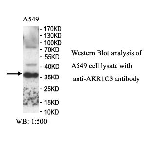 AKR1C3 Antibody