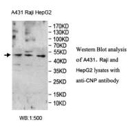 CNP Antibody