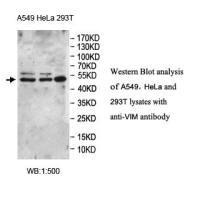 VIM Antibody