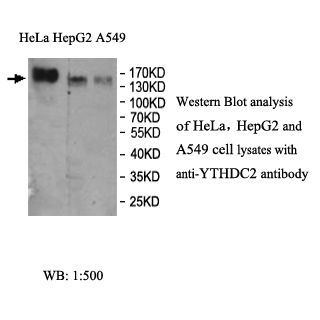 YTHDC2 Antibody