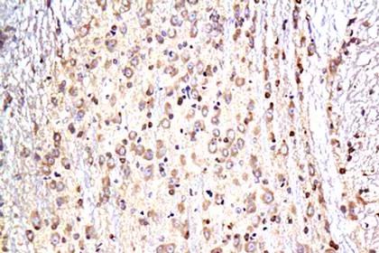 Biorbyt — 神经科学Neuroscience研究产品