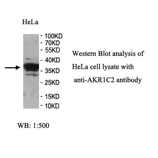 AKR1C2   Antibody