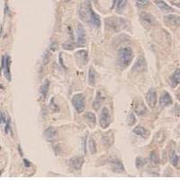Caspase 7 Antibody