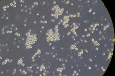 细胞抱团，怎么办？