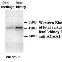 ACAA1 Antibody