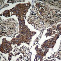 Akt(Phospho-Ser473) Antibody