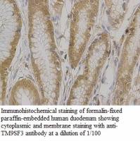 TM9SF3 Antibody