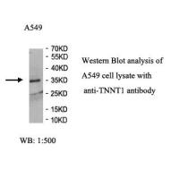 TNNT1 Antibody