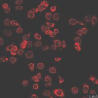 免疫荧光单标双标