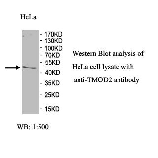 TMOD2 Antibody