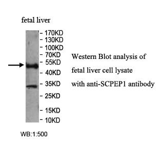 SCPEP1 Antibody