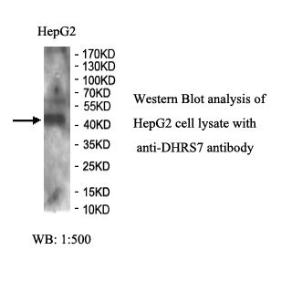 DHRS7 Antibody