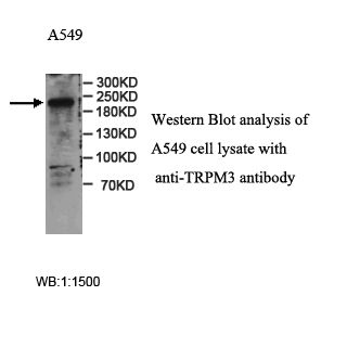 TRPM3 Antibody