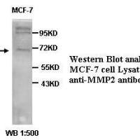 MMP2 Antibody