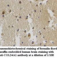 COL24A1 Antibody