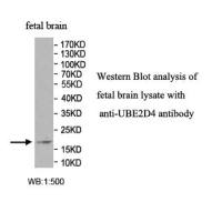 UBE2D4 Antibody
