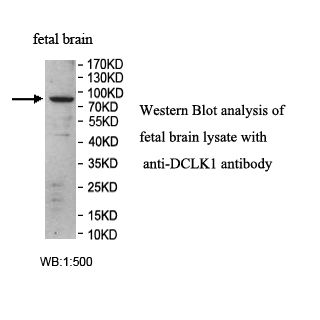 DCLK1 Antibody