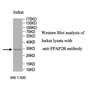 PPAP2B Antibody