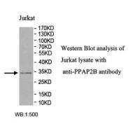 PPAP2B Antibody