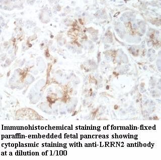 LRRN2 Antibody