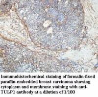 TULP1 Antibody