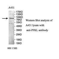 PFKL Antibody
