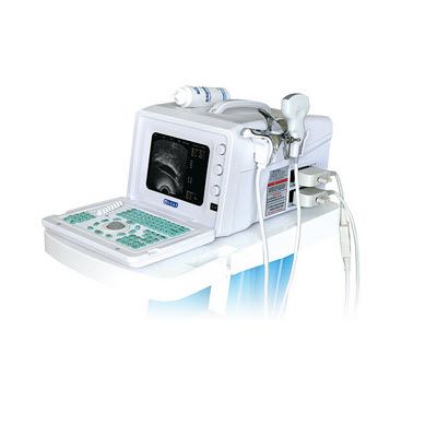 全数字超声妇产科手术监视仪 DW-400