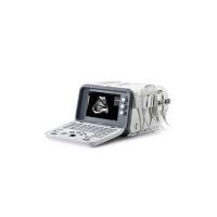 全数字超声诊断系统 DUS6