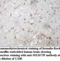 MKI67IP Antibody