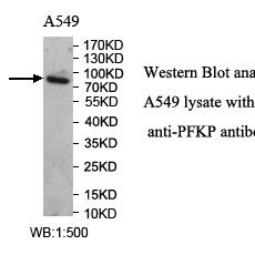 PFKP Antibody