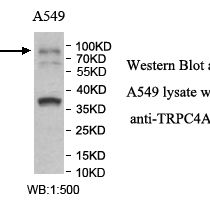 TRPC4AP Antibody