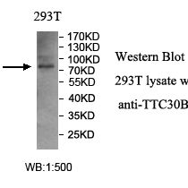 TTC30B Antibody