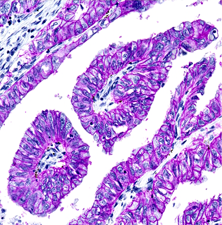 生物素姊妹篇——链霉亲和素及其衍生物
