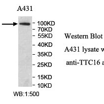 TTC16 Antibody